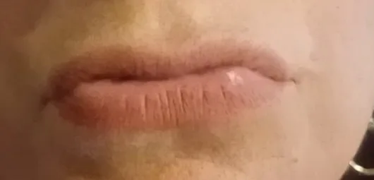 3. Second closure.